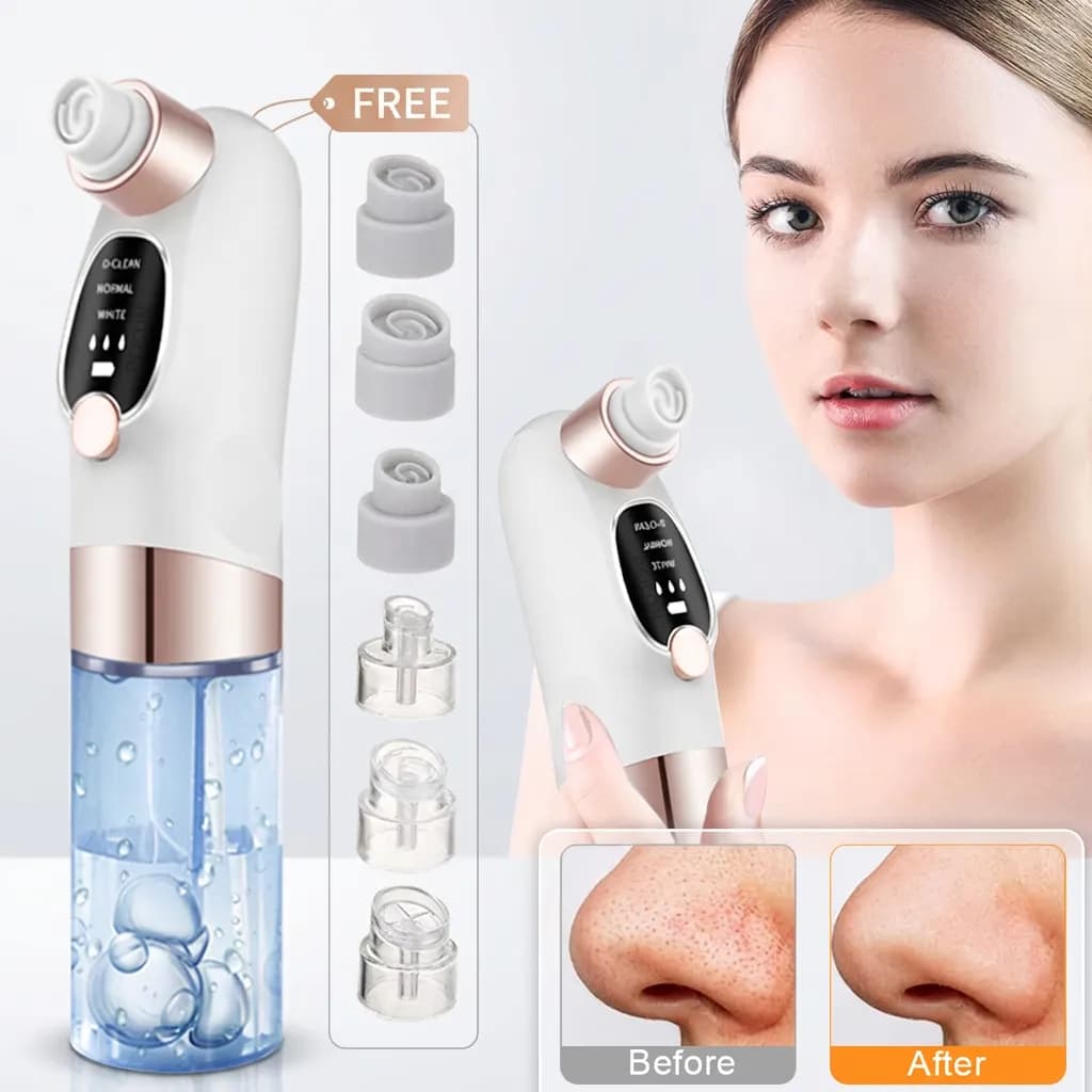 6-In-1 Blackhead Remover Pore Vacuum With 3 Levels, 6 Probes And USB Rechargeable Design